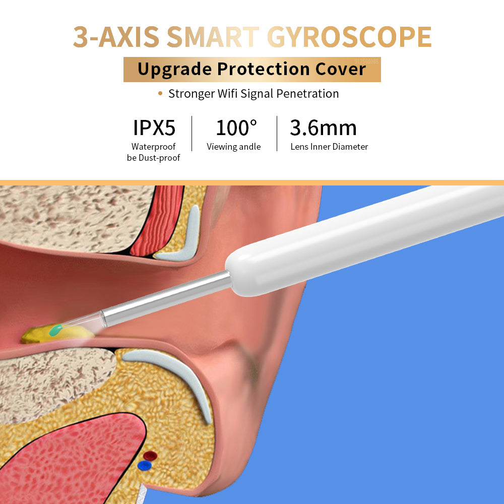 NE3 Wireless Visual Ear Wax Removal Tool with LED Camera.