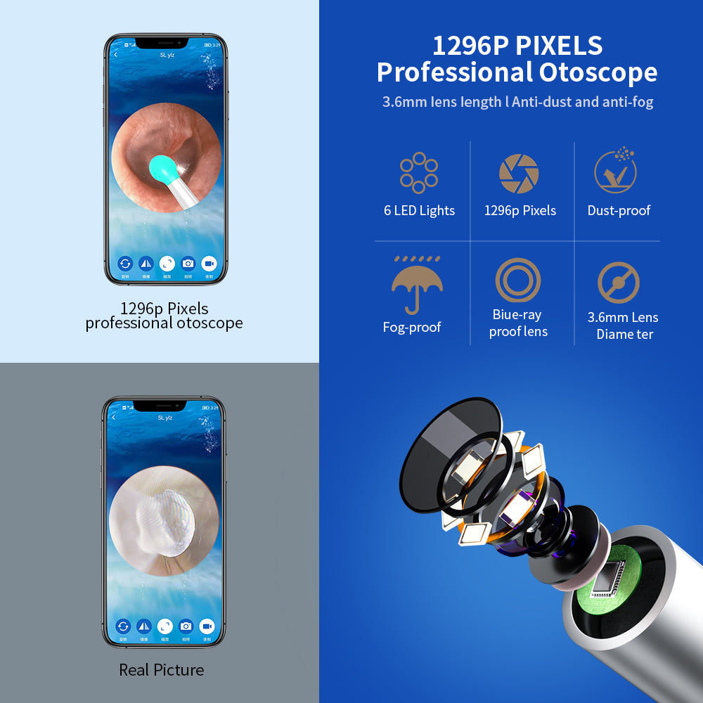 NE3 Wireless Visual Ear Wax Removal Tool with LED Camera.